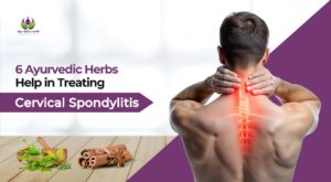 6 Ayurvedic Herbs Help in Treating Cervical Spondylitis