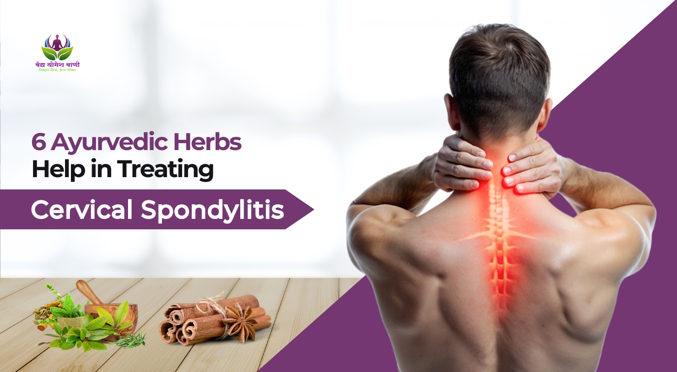 6 Ayurvedic Herbs Help in Treating Cervical Spondylitis