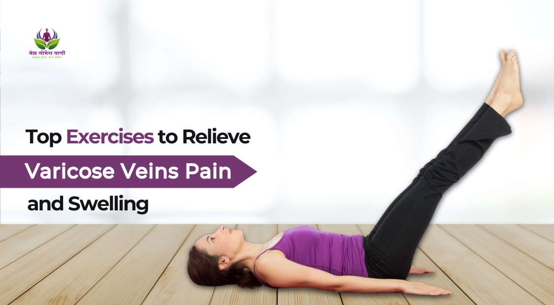Top Exercises to Relieve Varicose Veins Pain and Swelling