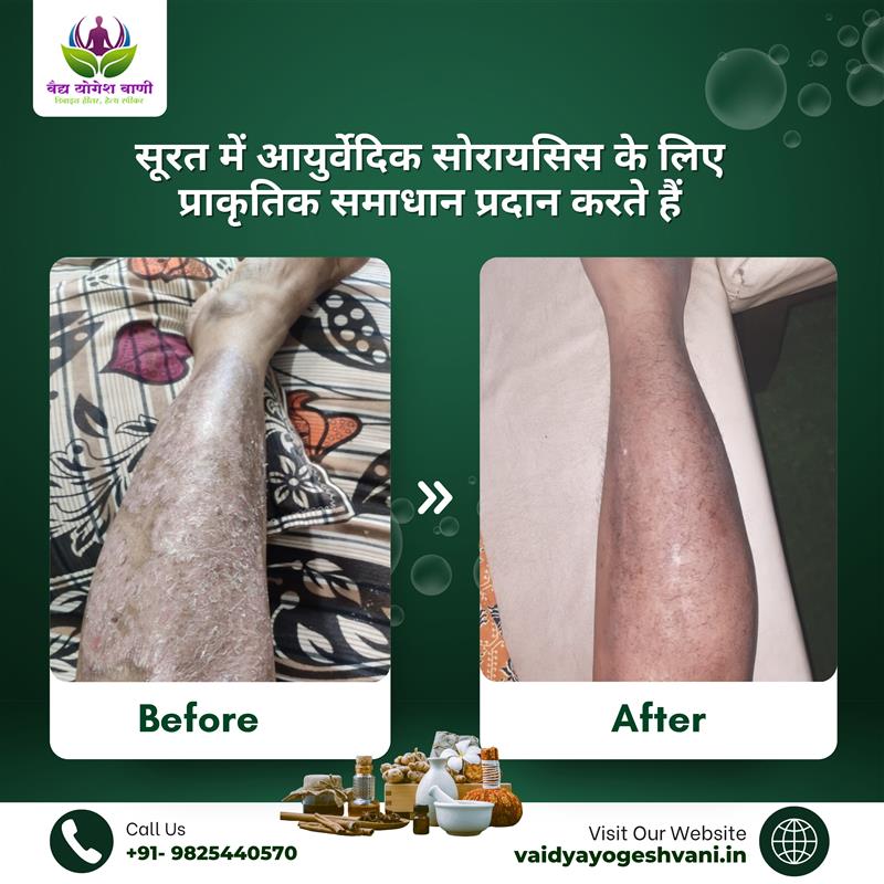 Dr. yogesh Vani (5) (1)