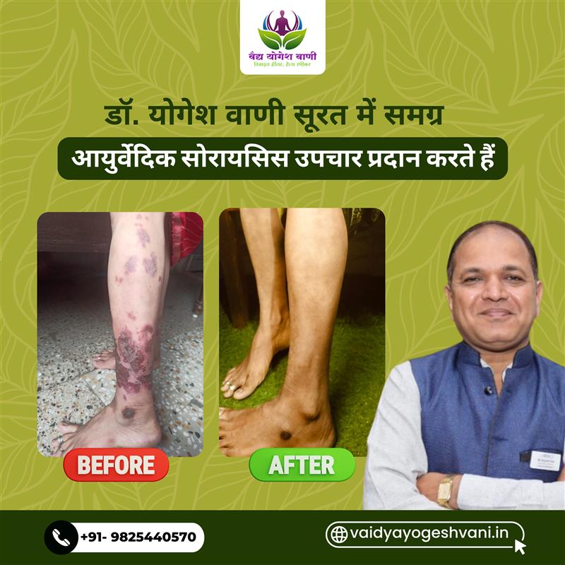 Dr. yogesh Vani (6) (1)
