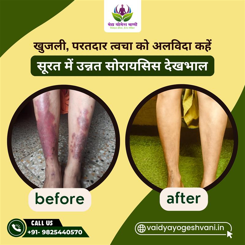 Dr. yogesh Vani (7) (1)