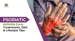 Psoriatic Arthritis Cure: Treatments, Diet & Lifestyle Tips