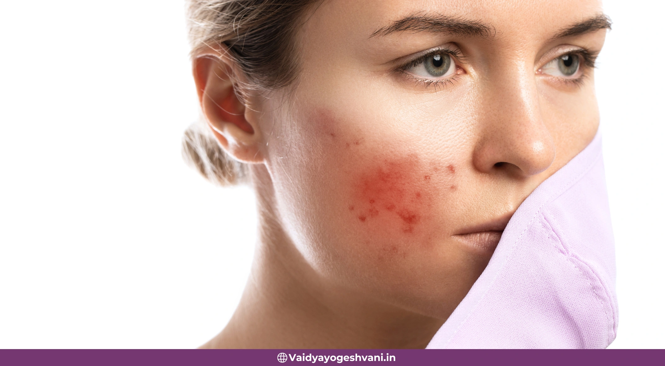 Skin Looks Dull or You Get Breakouts