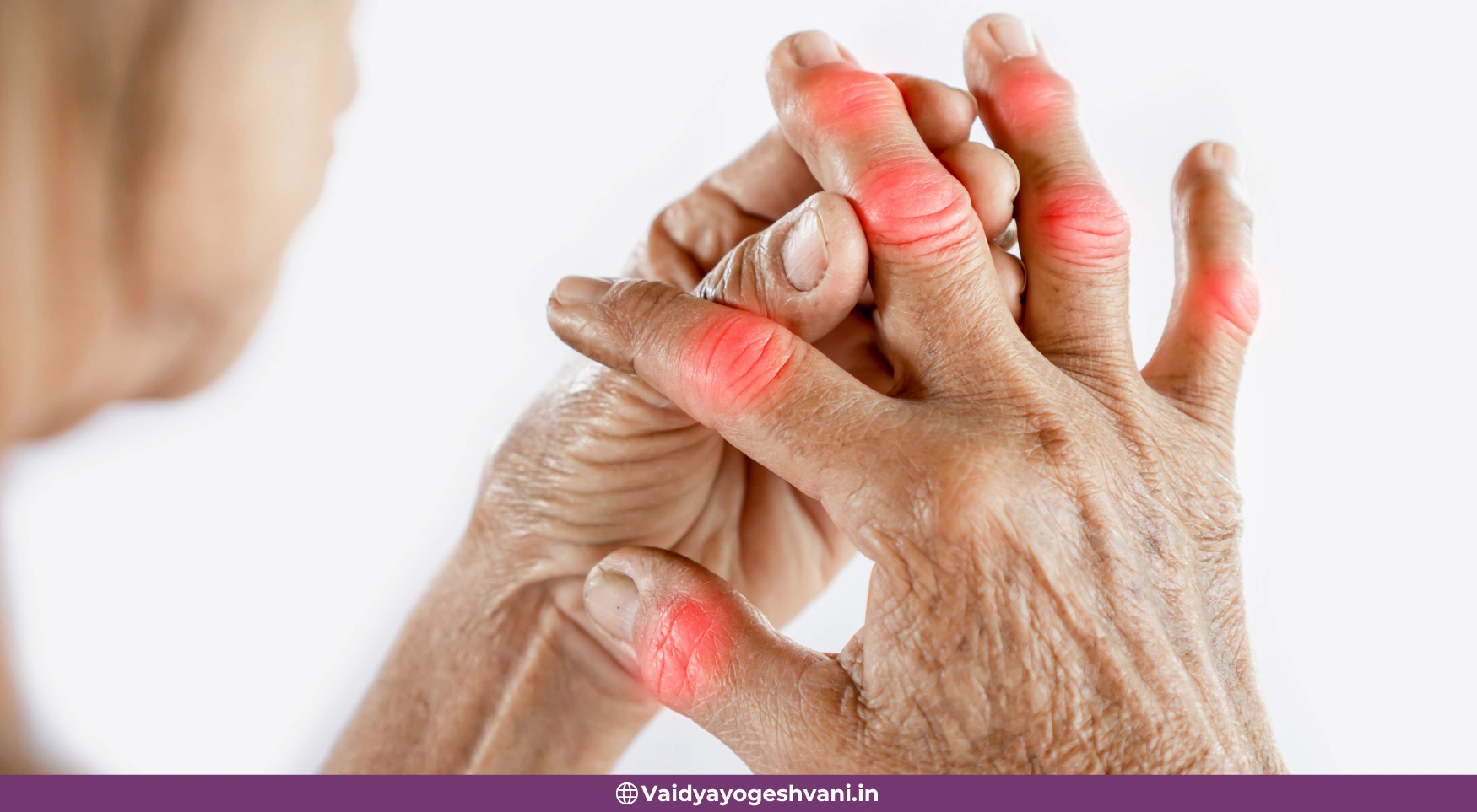 Diet Plan For Arthritis Treatment