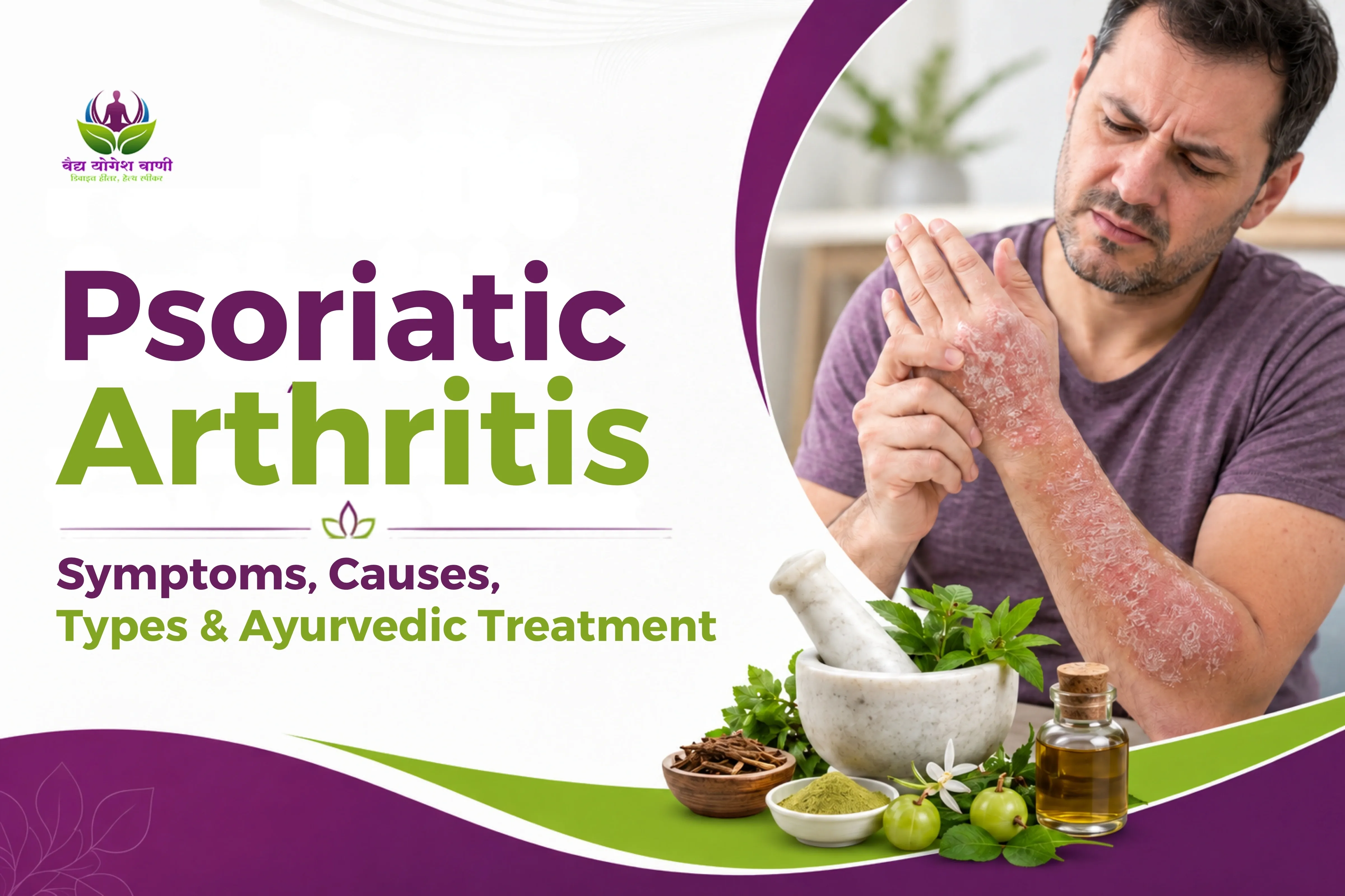 Psoriatic Arthritis: Symptoms, Causes, Types & Ayurvedic Treatment