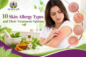 10 Skin Allergy Types and Their Treatment Options