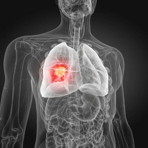 Types of Cancers Managed with Ayurveda (2) Types of Cancers Managed with Ayurveda (2)